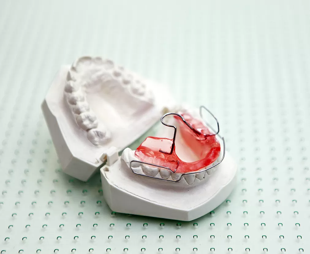 Bionator appliance on a dental model